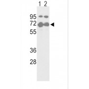 Nuclear Factor, Erythroid Derived 2 Like 2 (NFE2L2) Antibody