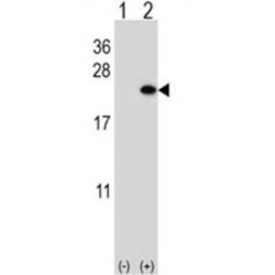 Homeobox Protein BarH-Like 1 (BARX1) Antibody
