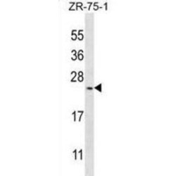 Homeobox Protein BarH-Like 1 (BARX1) Antibody