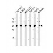 WB analysis of (1) U-87, (2) U-2OS whole cell lysates, (3) SH-using H-SY5Y whole cell lysate, (4) 293T/17 whole cell lysate, (5) HepG2 whole cell lysate and (6) Mouse brain lysate Lysates/proteins at 20 µg per lane using EN1 Antibody.