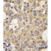 Poly[ADP-Ribose] Glycohydrolase (Parg) Antibody