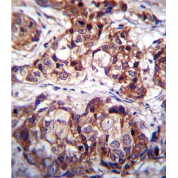Epithelial Discoidin Domain-Containing Receptor 1 (DDR1) Antibody