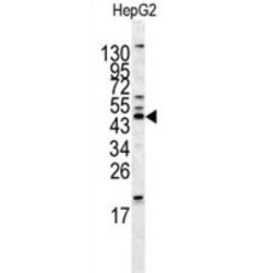 Homer Homolog 1 (Drosophila) (HOMER1) Antibody