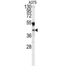 Carbonic Anhydrase 14 (CA14) Antibody