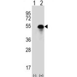 Carbonic Anhydrase 14 (CA14) Antibody