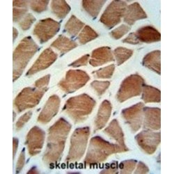 Carbonic Anhydrase VB, Mitochondrial (CA5B) Antibody