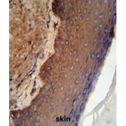 Keratin, Type I Cytoskeletal 9 (KRT9) Antibody