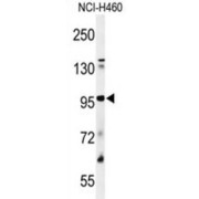 Plasminogen (PLG) Antibody