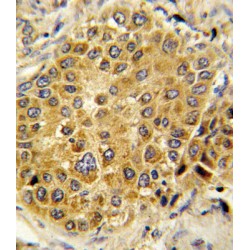 Plasminogen (PLG) Antibody