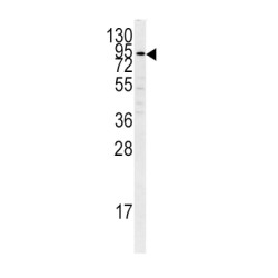 Plasminogen (PLG) Antibody