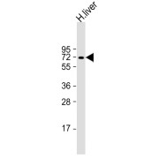 abx033319