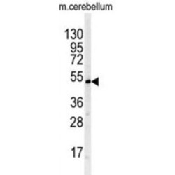 BTB/POZ Domain-Containing Protein 1 (BTBD1) Antibody