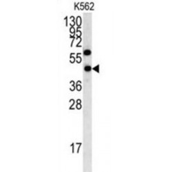 Ly1 Antibody Reactive (LYAR) Antibody