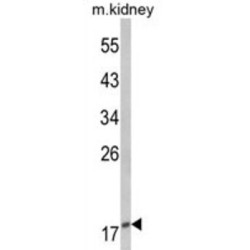 Parathyroid Hormone-Related Protein / PTHrP (PTHLH) Antibody