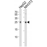 Western blot analysis of (1) HepG2, and (2) mouse NIH/3T3 cell line lysates (35 µg/lane), using PTHLH antibody (1/1000 dilution) and HRP-conjugated goat anti-rabbit IgG (1/5000 dilution).