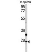 WB analysis of mouse spleen tissue lysates (35 µg/lane).