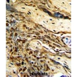O-6-Methylguanine DNA Methyltransferase (MGMT) Antibody