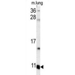 S100 Calcium Binding Protein A6 (S100A6) Antibody