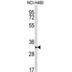 NAD(P)H Dehydrogenase, Quinone 1 (NQO1) Antibody