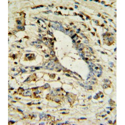 Apolipoprotein L (APOL1) Antibody