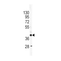 Apolipoprotein L (APOL1) Antibody