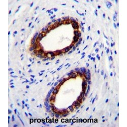 Cytokeratin-18 (CYK18) Antibody