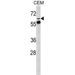 FK506 Binding Protein 10 (FKBP10) Antibody