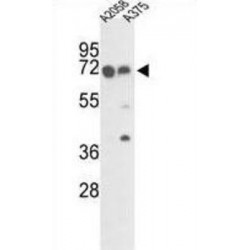 FK506 Binding Protein 10 (FKBP10) Antibody