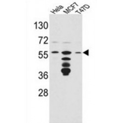 FK506 Binding Protein 4 (FKBP4) Antibody