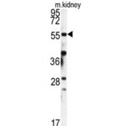 FK506 Binding Protein 9 (FKBP9) Antibody