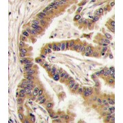 Casein Kinase I Isoform Alpha (CSNK1A1) Antibody