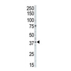 Casein Kinase I Isoform Alpha (CSNK1A1) Antibody