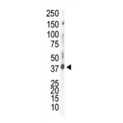 Casein Kinase 1 Delta (CSNK1D) Antibody