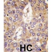 Casein Kinase I Isoform Gamma-2 (CSNK1G2) Antibody