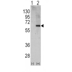 5'-AMP-Activated Protein Kinase Catalytic Subunit Alpha-2 (AMPK alpha 2) Antibody