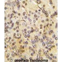 Menin (MEN1) Antibody