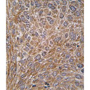 ARF GTPase Activating Protein GIT1 (GIT1) Antibody