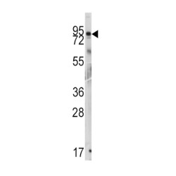 ARF GTPase Activating Protein GIT1 (GIT1) Antibody