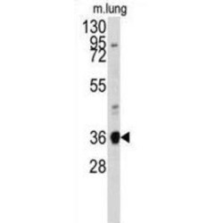 Annexin A2 (ANXA2) Antibody