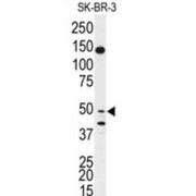 Bactericidal/permeability-Increasing Protein-Like 1 (BPIL1) Antibody