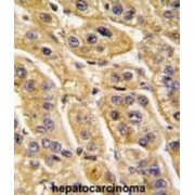 3-Hydroxyisobutyryl-CoA Hydrolase, Mitochondrial (HIBCH) Antibody
