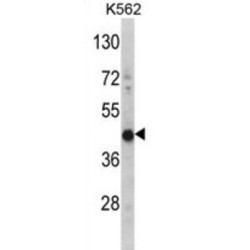 3-Hydroxyisobutyryl-CoA Hydrolase, Mitochondrial (HIBCH) Antibody