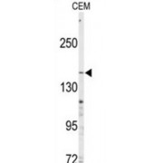 Multidrug Resistance-Associated Protein 4 (ABCC4) Antibody