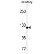 A Disintegrin And Metalloproteinase With Thrombospondin 19 (ADAMTS19) Antibody