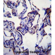 Fatty Acid Synthase (FASN) Antibody