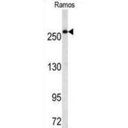 Fatty Acid Synthase (FASN) Antibody
