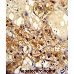 Cytochrome P450 20A1 (CYP20A1) Antibody