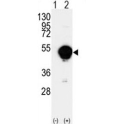 Cytochrome P450 20A1 (CYP20A1) Antibody