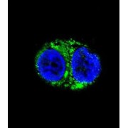 Isocitrate Dehydrogenase [NADP] Cytoplasmic (IDH1) Antibody