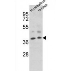 Homeobox Protein Engrailed-2 (EN2) Antibody